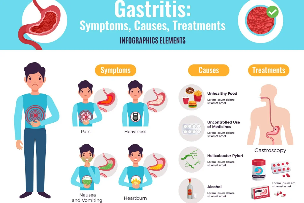 Common Stomach Disease