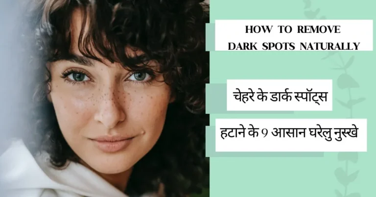 How To Remove Dark Spots Naturally